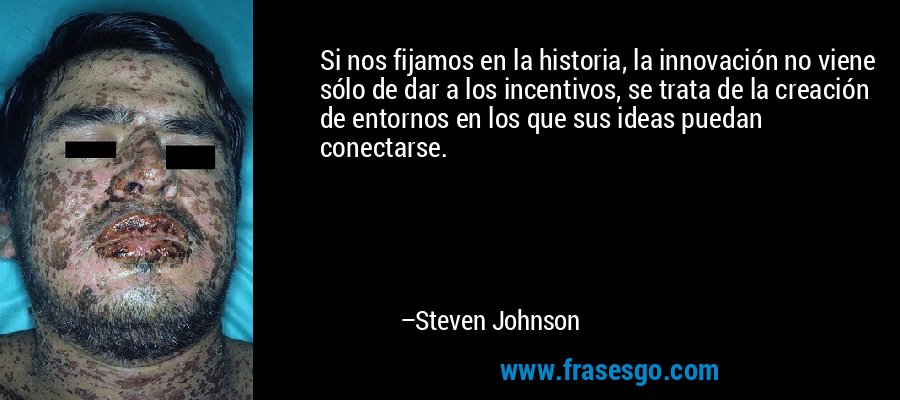 Si nos fijamos en la historia, la innovación no viene sólo de dar a los incentivos, se trata de la creación de entornos en los que sus ideas puedan conectarse. – Steven Johnson